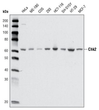 Figure 1: Western blot analysis using CHK2 mouse mAb against cell lysate from various cell types.