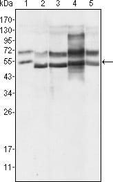 Figure 1: Western blot analysis using GABPA mouse mAb against Hela (1), A549 (2), MCF-7 (3), NIH/3T3 (4) and SMMC-7721 (5) cell lysate.