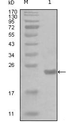 Figure 1: Western blot analysis using CHUK mouse mAb against truncated Trx-CHUK recombinant protein (1).