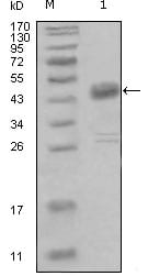 Figure 1: Western blot analysis using DDR1 mouse mAb against truncated MBP-DDR1 recombinant protein (1).