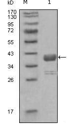 Figure 1: Western blot analysis using ABL1 mouse mAb against truncated GST-ABL1 recombinant protein (1).