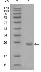 Figure 1: Western blot analysis using AXL mouse mAb against truncated Trx-AXL recombinant protein (1).
