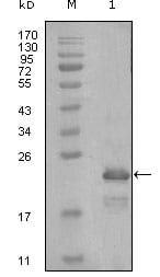 Figure 1: Western blot analysis using HAND1 mouse mAb against truncated Trx-HAND1 recombinant protein (1).