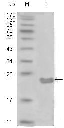 Figure 1: Western blot analysis using CD10 mouse mAb against truncated CD10-His recombinant protein (1).