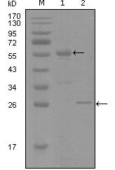 Figure 1: Western blot analysis using PGR mouse mAb against truncated MBP-PGR recombinant protein (1) and truncated Trx-PGR(aa730-871) recombinant protein (2).