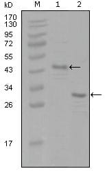 Figure 1: Western blot analysis using ESR1 mouse mAb against truncated Trx-ESR1 recombinant protein (1) and truncated ESR1(aa130-339)-His recombinant protein (2).