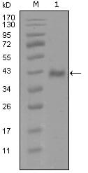 Figure 1: Western blot analysis using AR mouse mAb against truncated Trx-AR recombinant protein (1).