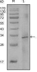 Figure 1: Western blot analysis using F8 mouse mAb against truncated Trx-F8 recombinant protein (1).