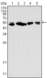 Figure 1: Western blot analysis using CK8 mouse mAb against A549 (1), Hela (2), MCF-7 (3), A431 (4) and HepG2 (5) cell lysate.