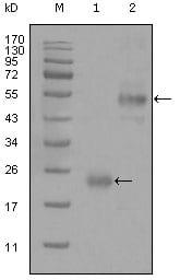 Figure 1: Western blot analysis using CD44 mouse mAb against truncated Trx-CD44 recombinant protein (1) and GST-CD44 (aa628-699) recombinant protein (2).