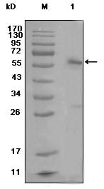 Figure 1: Western blot analysis using ESR1 mouse mAb against MCF-7 cell lysate (1)