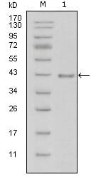 Figure 1: Western blot analysis using LAMB1 mouse mAb against truncated LAMB1-His recombinant protein (1).