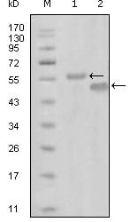 Figure 1: Western blot analysis using EphA6 mouse mAb against truncated MBP-EphA6 recombinant protein (1) and truncated GST-EphA6(aa695-795) recombinant protein (2).