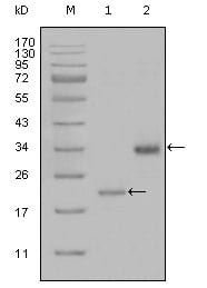 Figure 1: Western blot analysis using LPA mouse mAb against truncated LPA-His recombinant protein (1) and truncated Trx-LPA(aa4330-4521) recombinant protein (2).