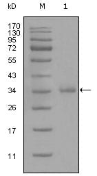 Figure 1: Western blot analysis using anti-CD45 monoclonal antibody against truncated CD45 recombinant protein (1).
