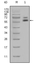 Figure 1: Western blot analysis using CK5 mouse mAb against Hela cell lysate (1).