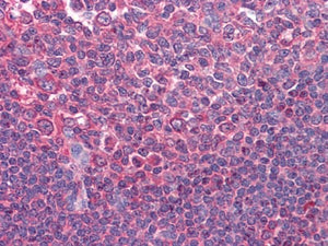 Figure 1: Immunohistochemical analysis of paraffin-embedded human Tonsil tissues using anti-CD80 mAb