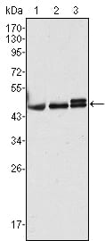 Figure 1: Western blot analysis using CK17 mouse mAb against Hela (1), MCF-7 (2) and A431 (3) cell lysate.