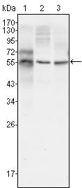Figure 1: Western blot analysis using TUBB3 mouse mAb against HepG2 (1), A549 (2) and Hela (3) cell lysate.