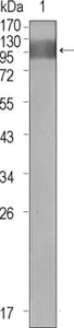 Figure 1: Western blot analysis using FLT1 mouse mAb against extracellular domain of human FLT1.