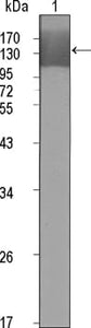 Figure 1: Western blot analysis using KDR mouse mAb against extracellular domain of human KDR (aa20-764).