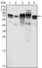 Figure 1: Western blot analysis using Metadherin mouse mAb against K562 (1), SKBR-3 (2), T47D (3), Hela (4) and MCF-7 (5) cell lysate.