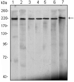 Figure 1: Western blot analysis using CHD3 mouse mAb against Hela (1), K562 (2), Jurkat (3), NTERA-2 (4), HEK293 (5), Raji (6) cell lysate and mouse brain (7) tissue lysate.
