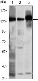 Figure 1: Western blot analysis using SMC1 mouse mAb against K562 (1), Jurkat (2) and A549 (3) cell lysate.