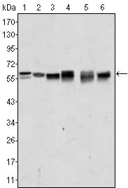 Figure 1: Western blot analysis using AKT2 mouse mAb against A431 (1), Jurkat (2), HEK293 (3), A549 (4), MCF-7 (5) and PC-12 (6) cell lysate.