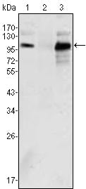 Figure 1: Western blot analysis using Androgen receptor mouse mAb against K562 (1), Jurkat (2) and LNCaP (3) cell lysate.