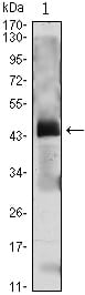 Figure 1: Western blot analysis using PTH mAb against PTH(AA: 1-115)-hIgGFc transfected HEK293 cell lysate.