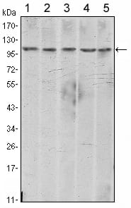 Figure 1: Western blot analysis using CDH2 mouse mAb against A431 (1), NIH/3T3 (2), Hela (3), C6 (4) and LNCap (5) cell lysate.
