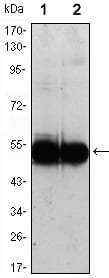 Figure 1: Western blot analysis using VCAM1 mouse mAb against HUVEC (1) and EC (2) cell lysate.