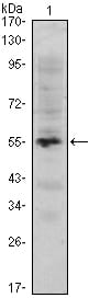 Figure 1: Western blot analysis using MUM1 mAb against human MUM1 (AA: 590-711) recombinant protein. (Expected MW is 39.8 kDa)