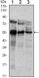 Figure 1: Western blot analysis using ETV5 mouse mAb against Jurkat (1), NIH/3T3 (2) and MCF-7 (3) cell lysate.