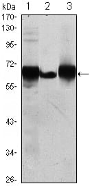 Figure 1: Western blot analysis using ALPP mouse mAb against HepG2 (1), A431 (2) and MCF-7 (3) cell lysate.