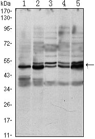 Figure 1: Western blot analysis using SMAD3 mouse mAb against A549 (1), Hela (2), Jurkat (3), PC-2 (4) and NIH/3T3 (5) cell lysate.