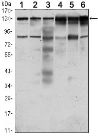 Figure 1: Western blot analysis using PTK7 mouse mAb against Hela (1), A431 (2), HCT116 (3), Caco2 (4), HepG2 (5) and MCF-7 (6) cell lysate.