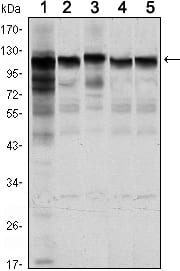 Figure 1: Western blot analysis using HK1 mouse mAb against Jurkat (1), Hela (2), HepG2 (3), MCF-7 (4) and PC-12 (5) cell lysate.