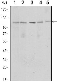Figure 1: Western blot analysis using SIRT1 mouse mAb against MCF-7 (1), Jurkat (2), Hela (3), HEK293 (4) and A549 (5) cell lysate.