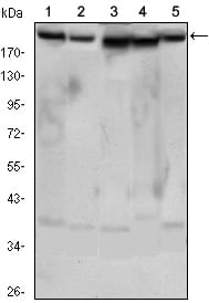 Figure 1: Western blot analysis using RICTOR mouse mAb against Hela (1), PANC-1 (2), MOLT4 (3), HepG2 (4) and HEK293 (5) cell lysate.