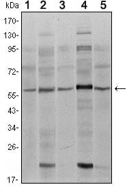 Figure 1: Western blot analysis using SMAD4 mouse mAb against A431 (1), SK-N-SH (2), K562 (3), HepG2 (4) and HUVE12 (5) cell lysate.