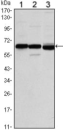 Figure 1: Western blot analysis using ESR1 mouse mAb against MCF-7 (1), T47D (2) and SKBR3 (3) cell lysate.