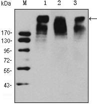 Figure 1: Western blot analysis using KI67 mouse mAb against Hela (1), MCF-7 (2) and Raji (3) cell lysate.