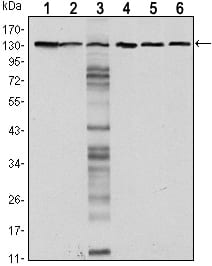 Figure 1: Western blot analysis using CDH1 mouse mAb against LNCAP (1)?A431 (2), DU145 (3), PC-3 (4), PC-12 (5) and T47D(6) cell lysate.