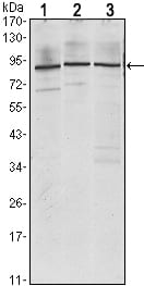 Figure 1: Western blot analysis using IGF2BP3 mouse mAb against Jurkat (1), K562 (2) and NTERA-2 (3) cell lysate.