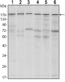 Figure 1: Western blot analysis using SETDB1 mouse mAb against MCF-7 (1)?T47D (2), HEK293 (3), JURKAT (4), NIH/3T3 (5) and F9 (6) cell lysate.