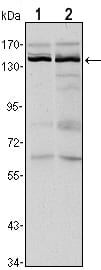 Figure 1: Western blot analysis using KDM3A mouse mAb against Hela (1) and HepG2 (2) cell lysate.