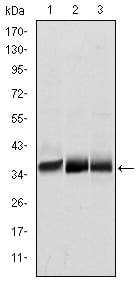 Figure 1: Western blot analysis using MSI2 mouse mAb against NTERA-2 (1), SW620 (2) and T47D (3) cell lysate.