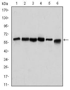 Figure 1: Western blot analysis using BECN1 mouse mAb against Hela (1), A431 (2), MCF-7 (3), RAJI (4), Jurkat (5) and SKBR-3 (6) cell lysate.
